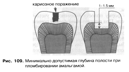 Вертикальная полость глубиной менее 20 м называется